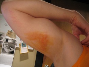 bikescrape1 scrape from mountain biking